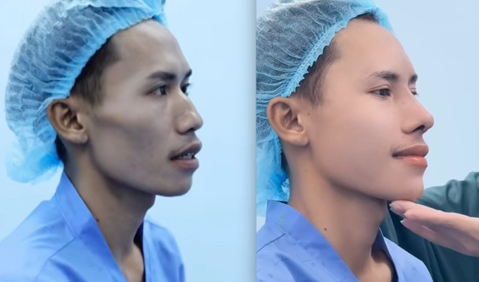 Quy trình làm đẹp của Lai Thai