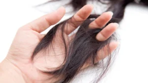 Khi nào thì xem là rụng tóc bất thường?